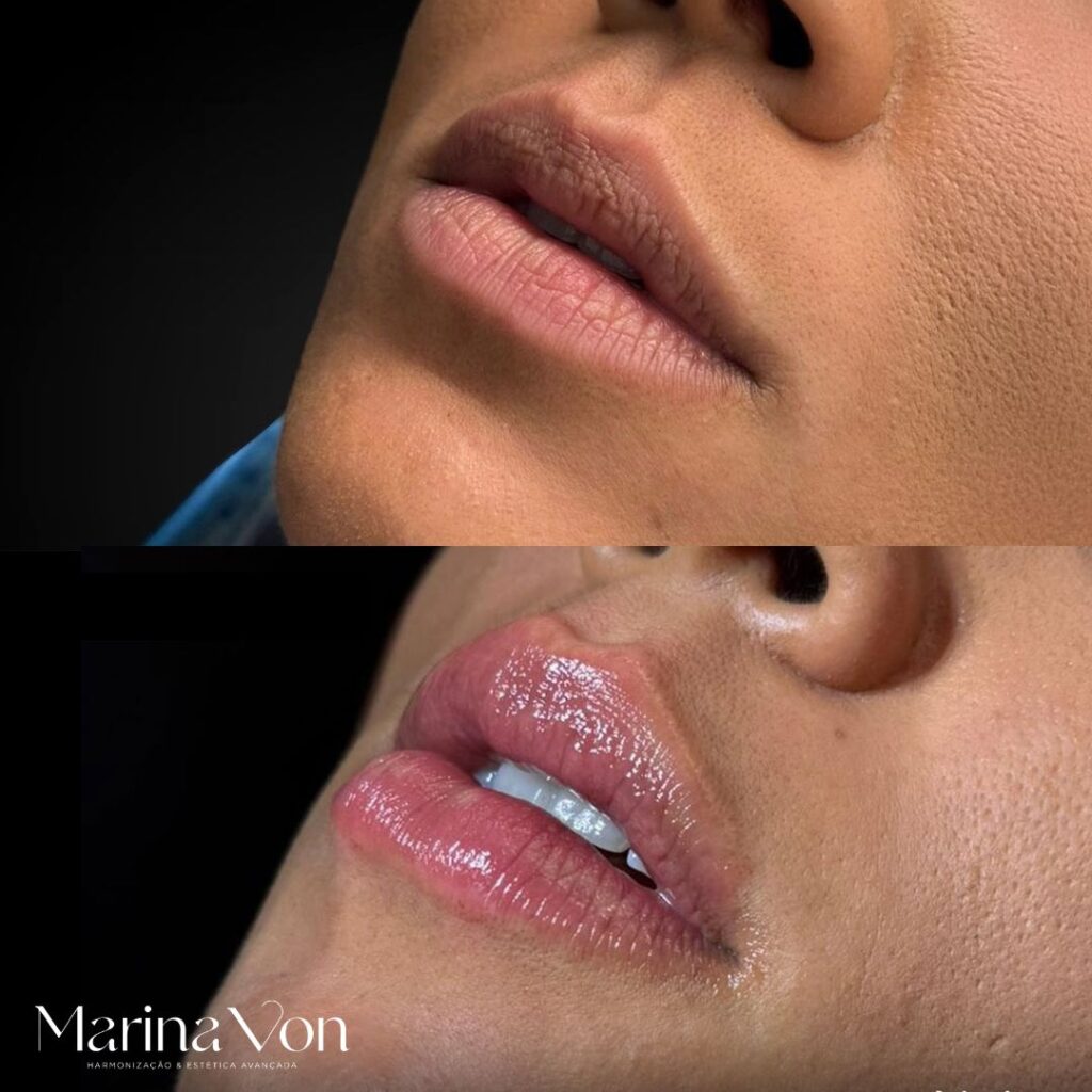 RESULTADOS MARINA VON